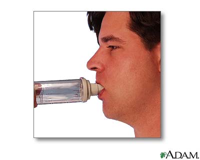 Spacer use - part four