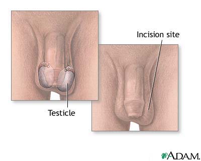 Testicular biopsy